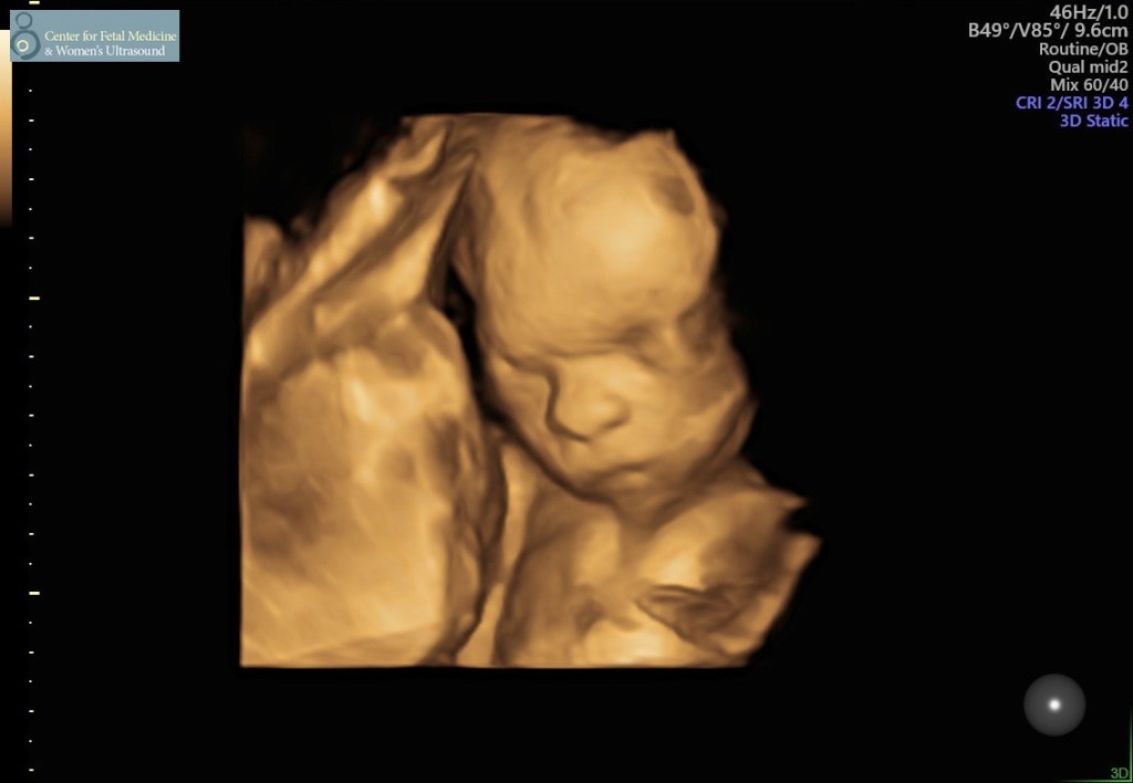 Cope?! That’s Easier Said Than Done